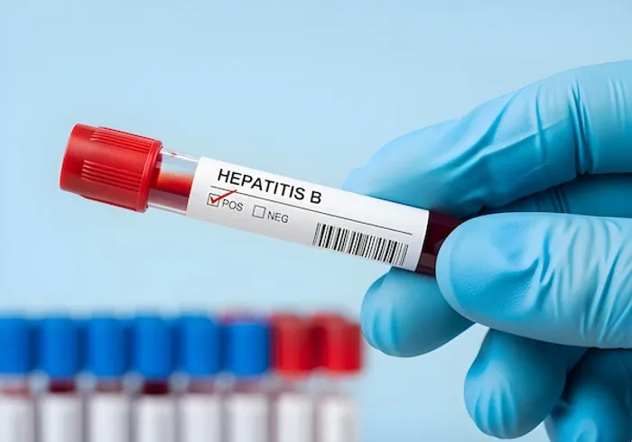 hepatitis B